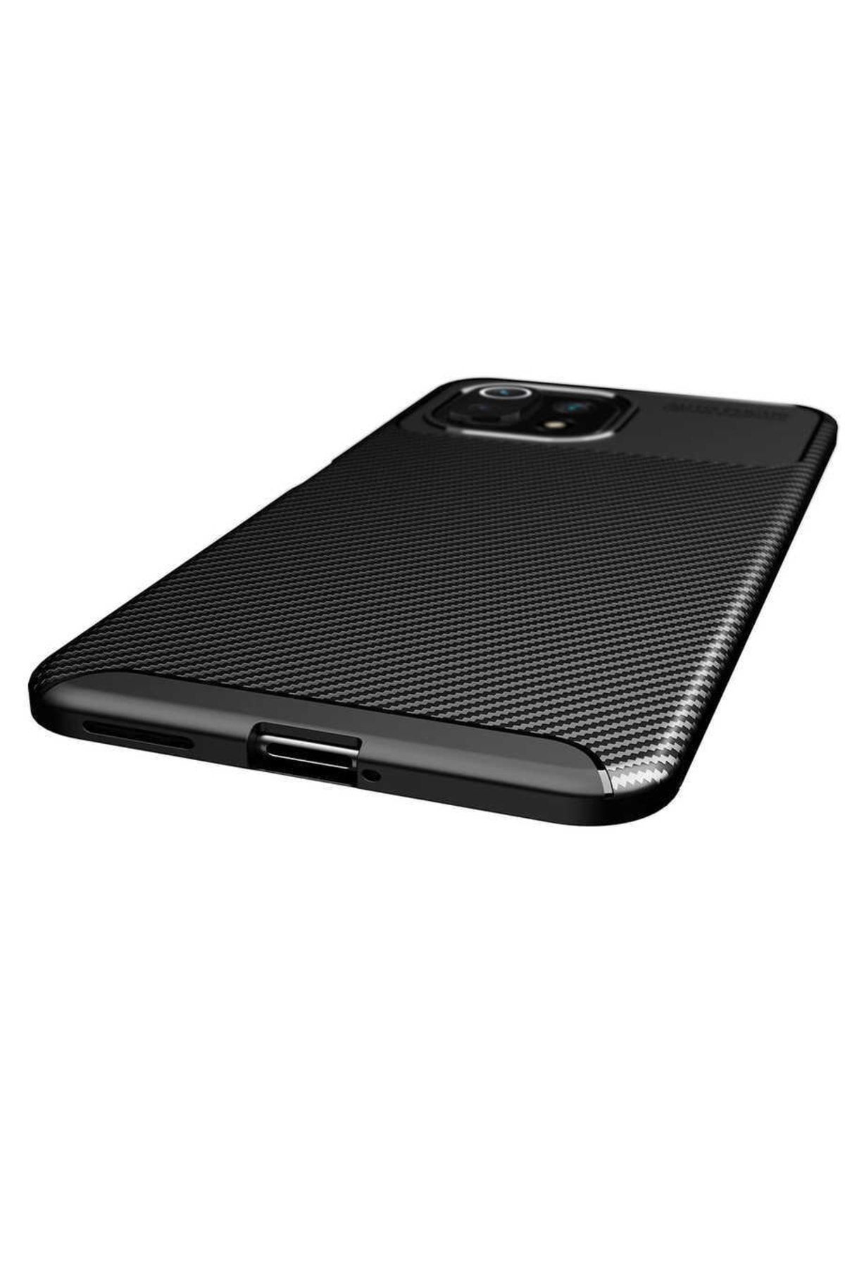 Xiaomi Mi 11 Lite Için Karbon Tasarımlı Negro Silikon Kılıf Kahverengi